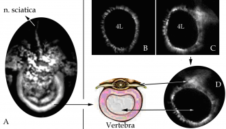 fig3 vertebra
