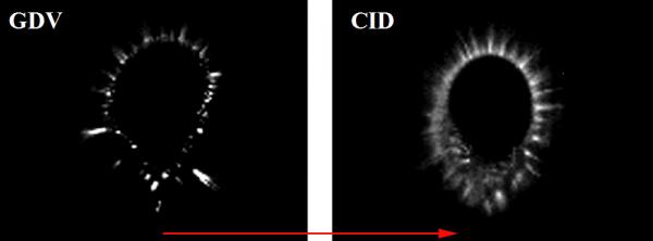 GDV vs CID